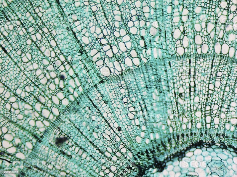 Circulation des sèves, nos arbres sont-ils tous égaux face au changement climatique&nbsp;?